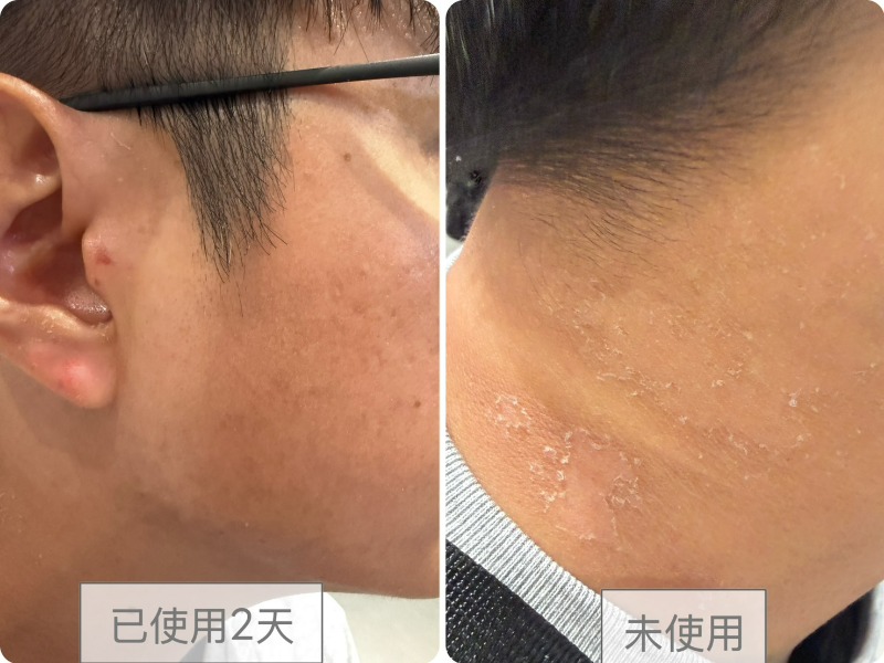 ✨不用開濾鏡 擦出天生好膚質✨韓國Dr. Vita 維他命醫生面霜SOS活膚駐顏面霜80ml(2027.3):圖片 15