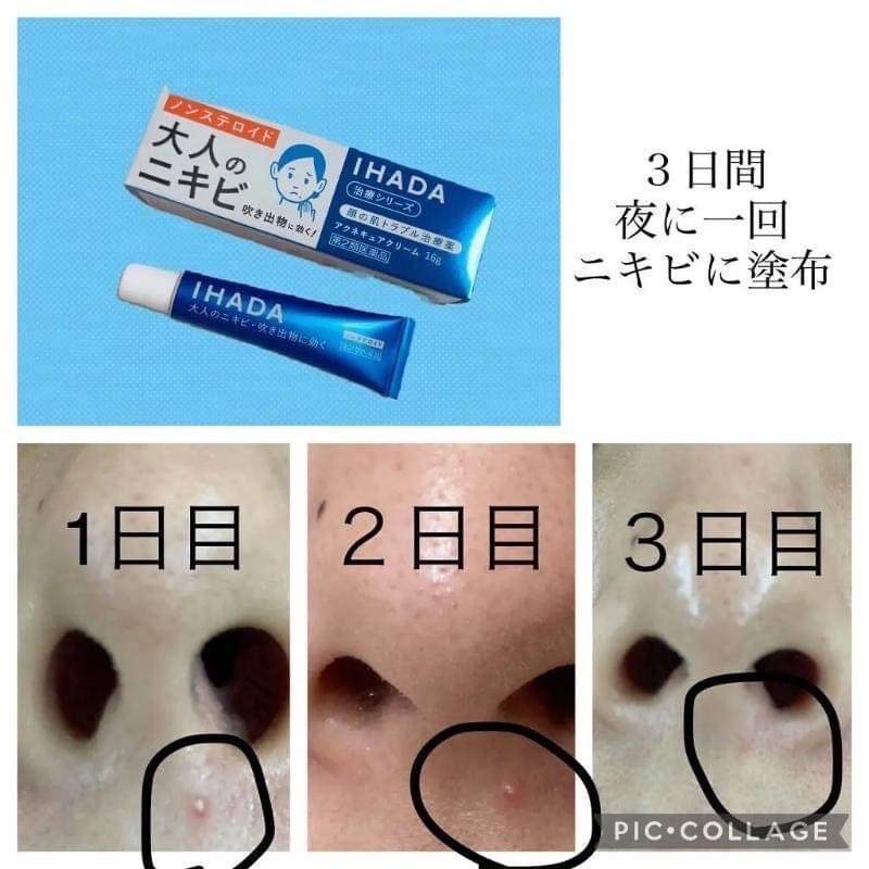日本資生堂 IHADA成人痘痘治療軟膏26g:圖片 4